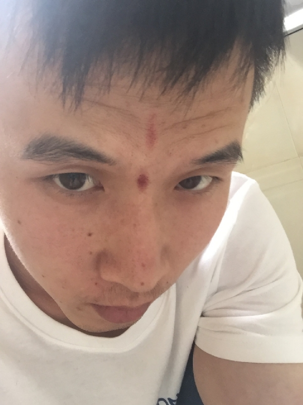 爱晴的第一张照片--海峡交友网